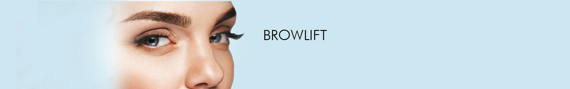 Browlift