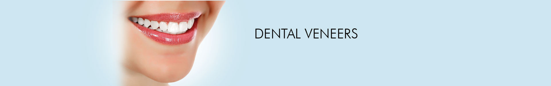 Dental Veeners